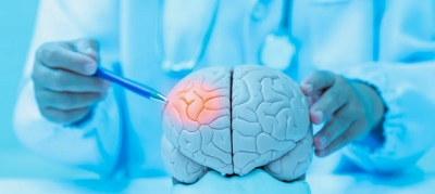 Почему важно выбрать профессионального невролога для здоровья нервной системы